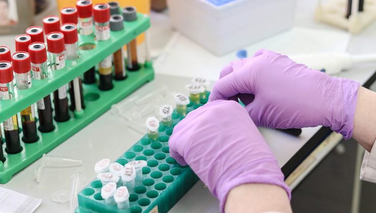 118 Yeni Koronavirüs Vakıası Kayıtlara Geçti