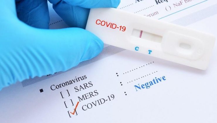 Covid 19 testi sertifikasının sahtesini yaptılar