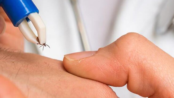 Piknik sezonu başlıyor, kenelere dikkat